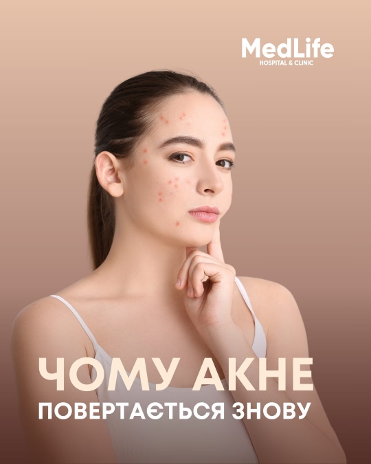 Чому акне повертається знову?